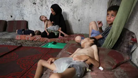 Rising Congenital Malformations in Gaza Amid Health Crisis and Conflict