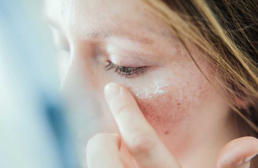 "القبح الشتوي".. كيف يؤثر الطقس البارد على بشرتك وكيفية الوقاية منه