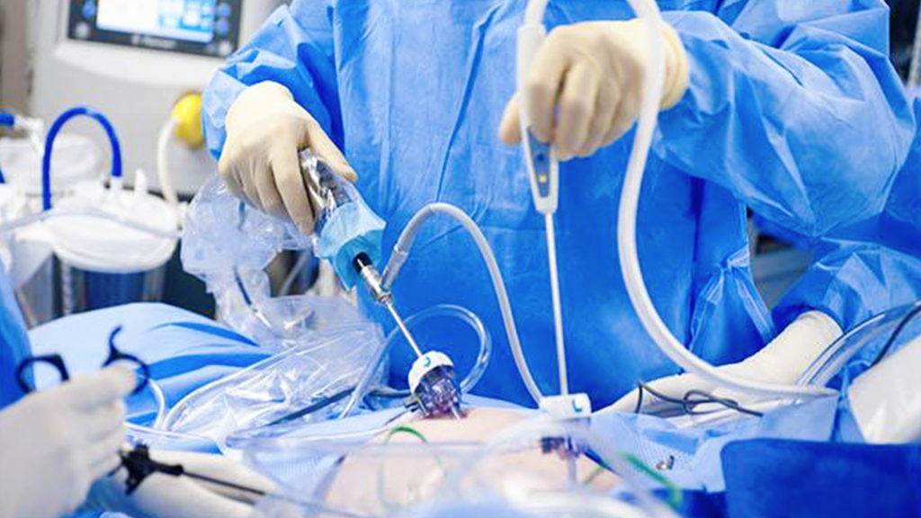 Medical Achievement in Cairo: Rare Surgery for an Infant Using Thoracoscopic Techniques