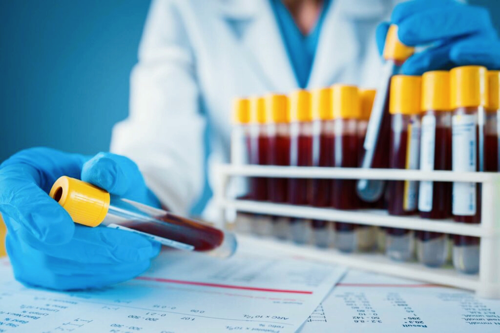 Innovative Blood Test May Change the Future of Cancer Treatment and ...