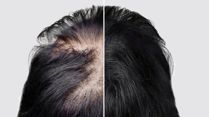 New Natural Serum Promises Hair Regrowth in Just Three Weeks