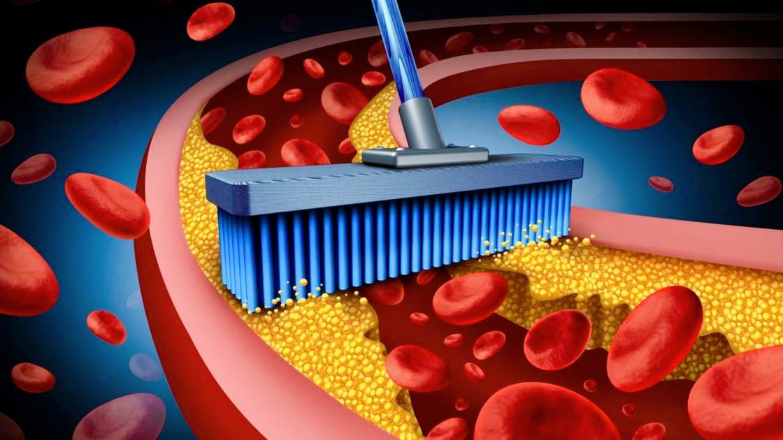 How to Identify High Cholesterol Levels Before They Become Dangerous