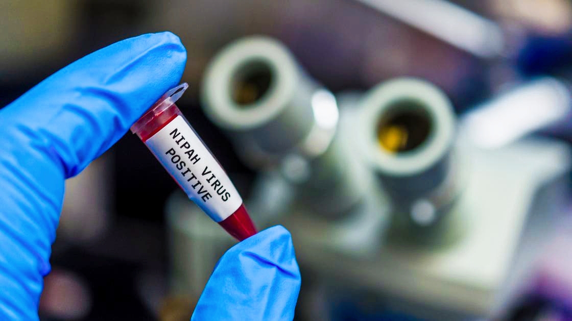 فيروس نيباه : جامعة طوكيو تبدأ أول اختبار بشري للقاح محتمل