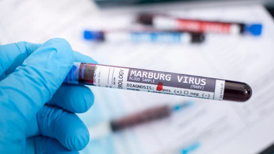 WHO Alerts on Marburg Virus Outbreak in Ethiopia