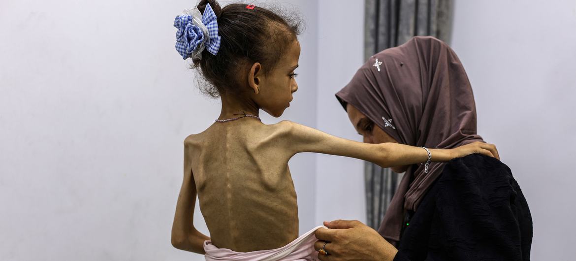 Gaza Health: The UN's decision to confirm famine "confirms the reality of Israeli starvation policy"